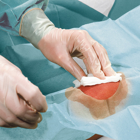 Foliodrape Protect Champ-OP troué 50x60cm avec trou Ø 5cm, sans bande adhésive, stérile, p.à 70 (double: non-tisse/plastifié)