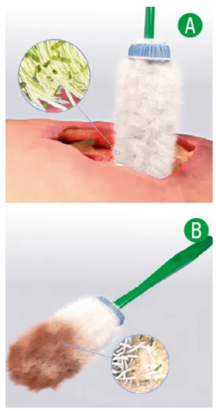 Debrisoft Lolly Wundreinigung 1,9x16cm P.à 5 steril einzeln versiegelt