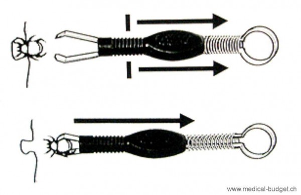 Zecken-Fix Zeckenpinzette aus Edelstahl mit abgewinkeltem Kopf sterilisierbar